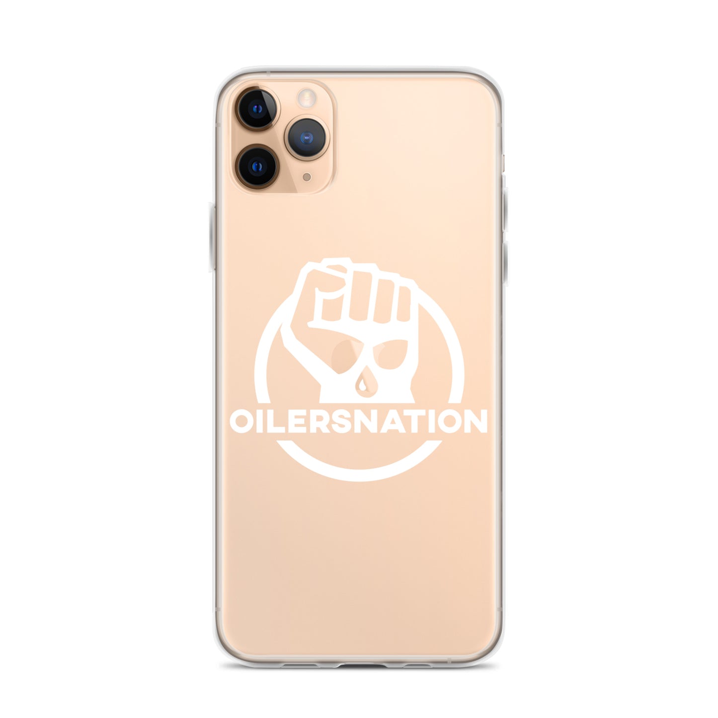 Oilersnation - Clear Case for iPhone® White Logo